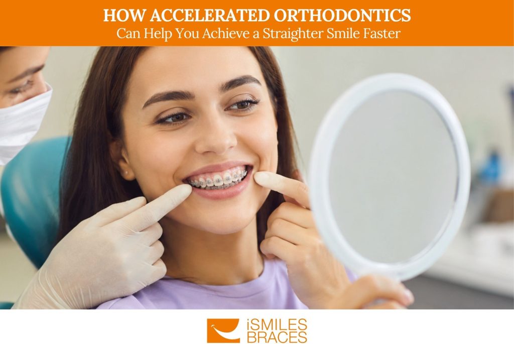 How Accelerated Orthodontics Can Help You Achieve a Straighter Smile Faster