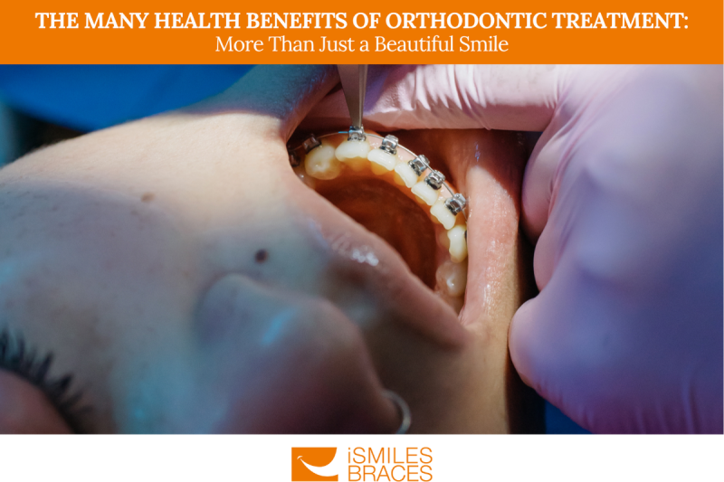 The Many Health Benefits of Orthodontic Treatment: More Than Just a Beautiful Smile